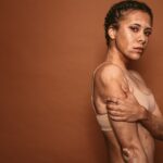 Vitiligo: la piel que también habla